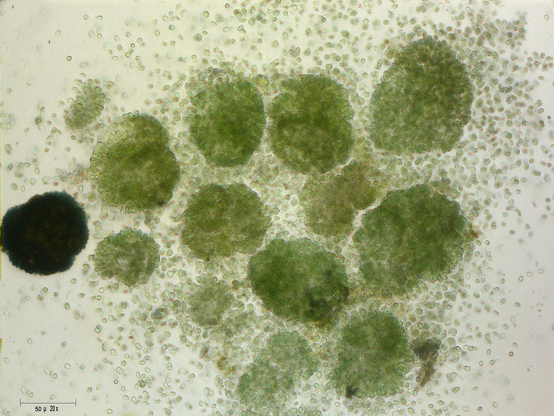 altra Microcystis sp.