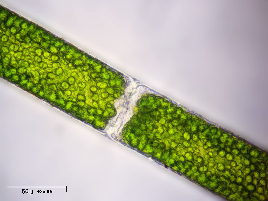 cloroplasti di Oedogonium