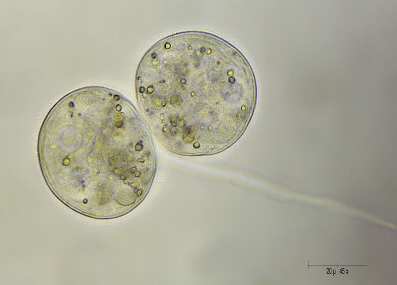 vorticella in divisione