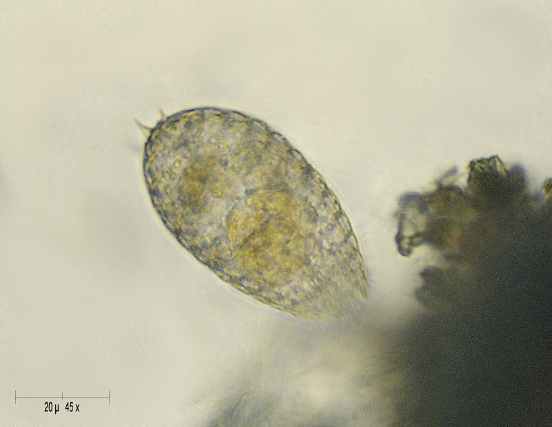 Coleps sp. al pascolo