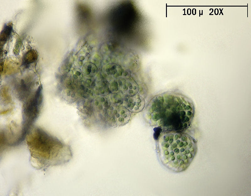 Sphaerocystis sp. ??