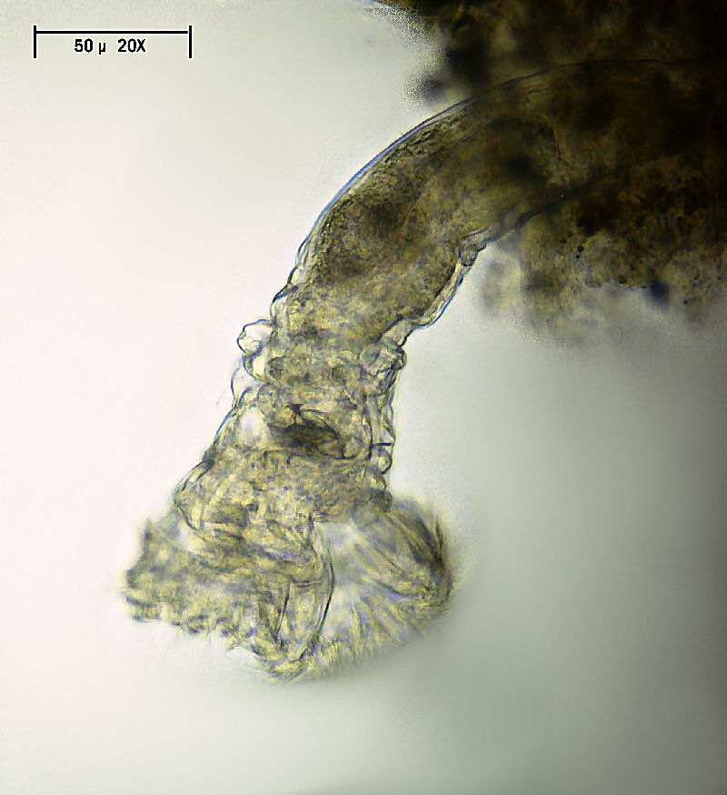 Ptygura sp. - un rotifero in un involucro gelatinoso