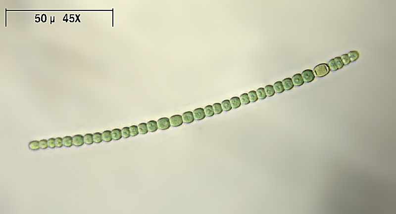 Anabaena sp.