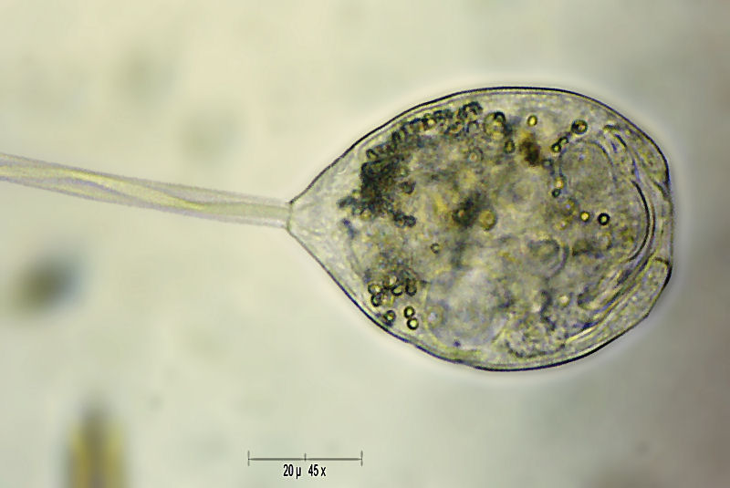 Vorticella sp.