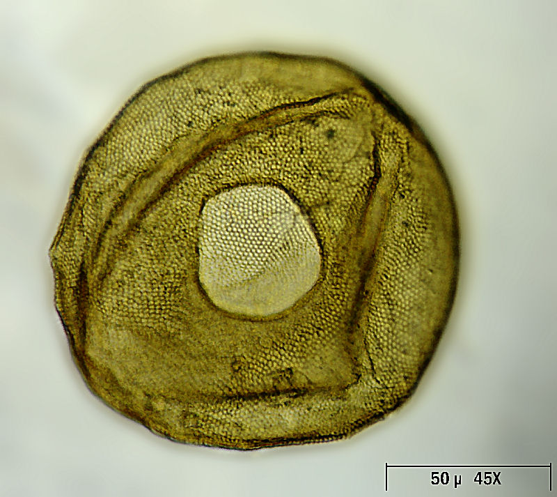 Arcella sp.