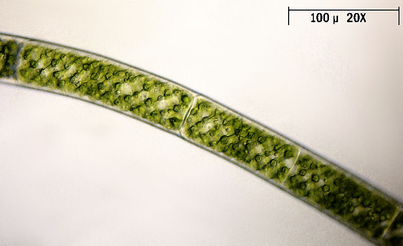 Spirogyra sp.