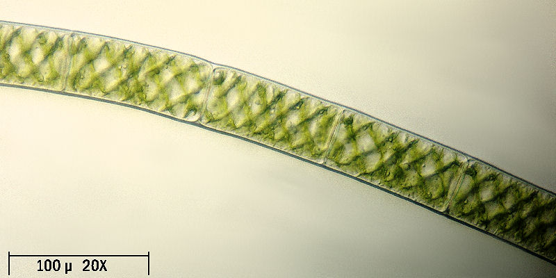 Spirogyra sp.