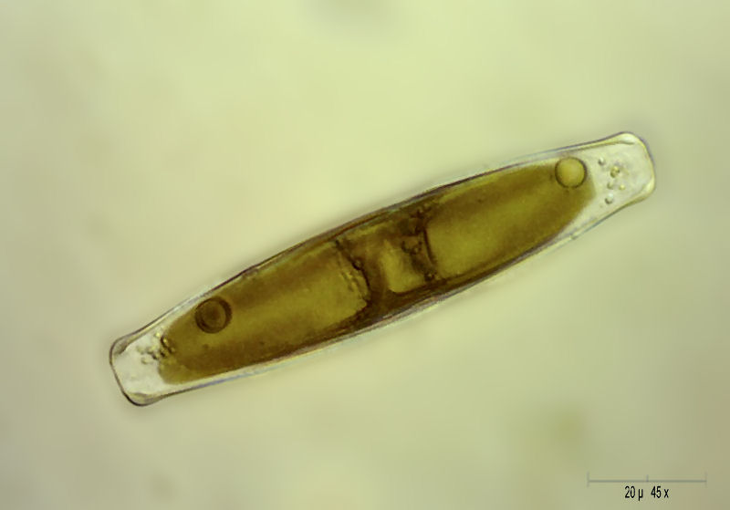 Navicula sp. ?