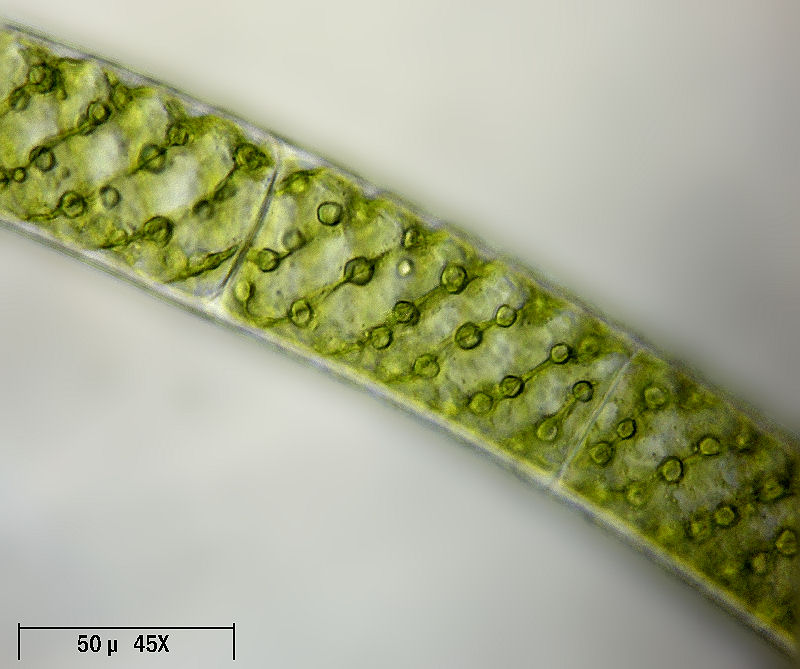 Spirogyra sp.