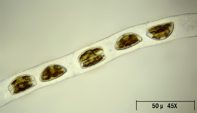 Encyonema prostratum