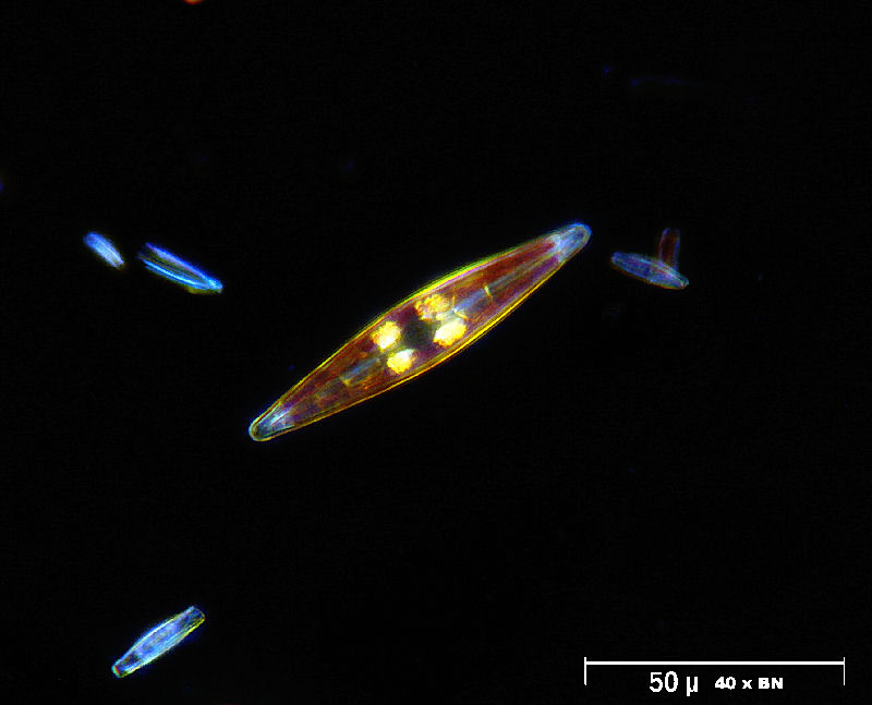 Navicula sp. in campo oscuro water immersion