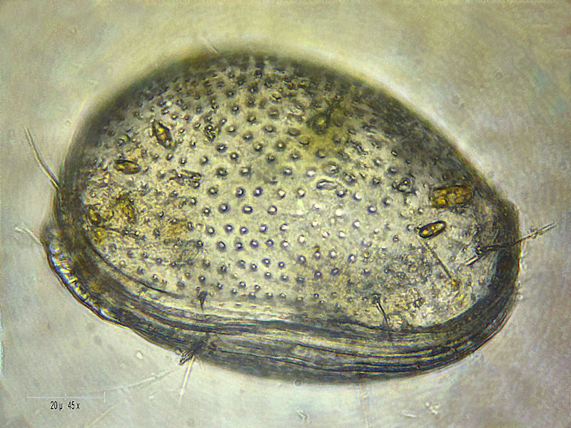 spoglie di ostracode