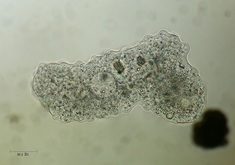 Amoeba verrucosa