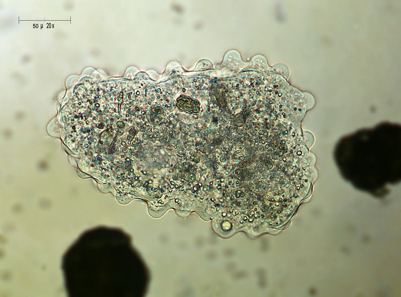 Amoeba verrucosa