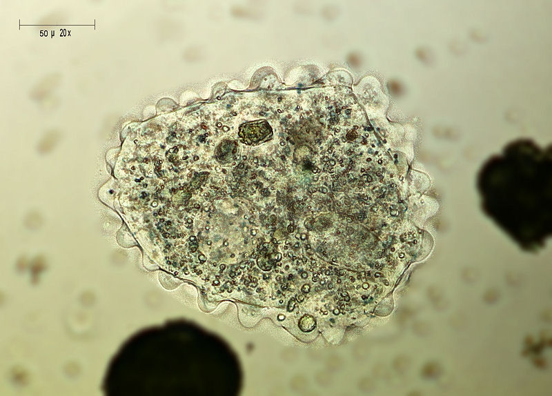 Amoeba verrucosa