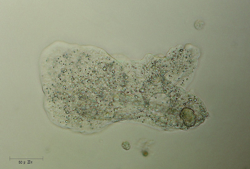 Amoeba verrucosa