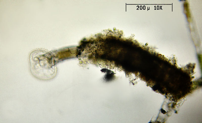 Ptygura sp. - un rotifero in un involucro gelatinoso