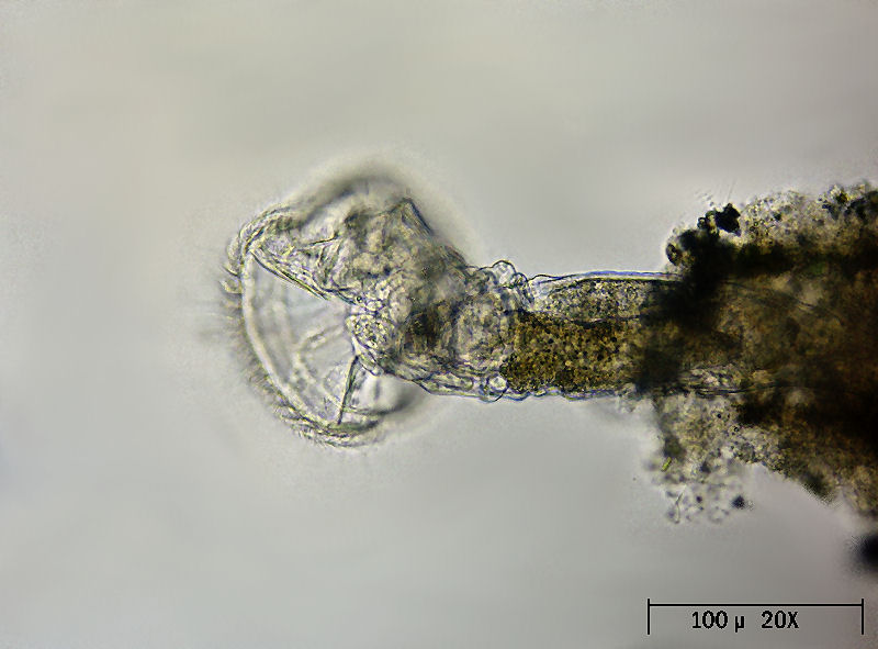 Ptygura sp. - un rotifero in un involucro gelatinoso