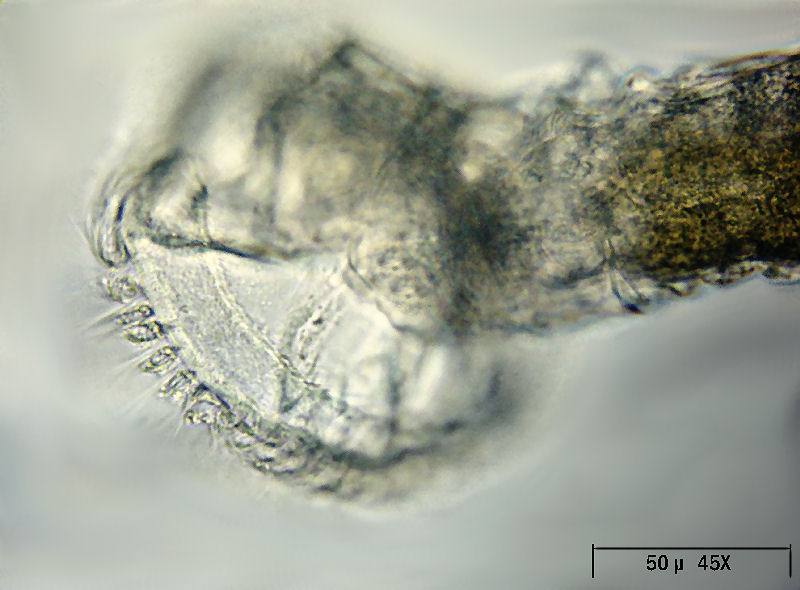 Ptygura sp. - un rotifero in un involucro gelatinoso