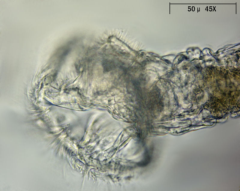 Ptygura sp. - un rotifero in un involucro gelatinoso