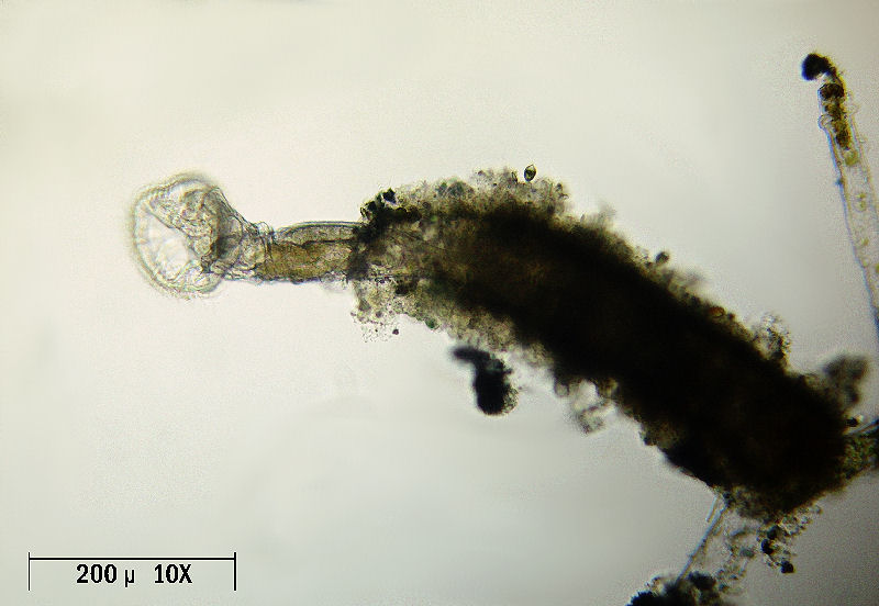 Ptygura sp. - un rotifero in un involucro gelatinoso