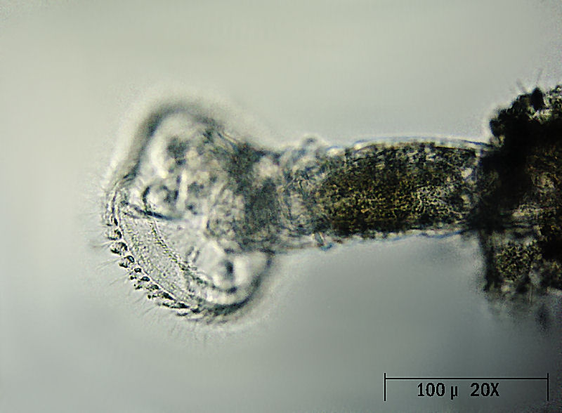 Ptygura sp. - un rotifero in un involucro gelatinoso
