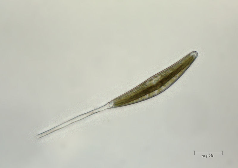 Cymbella sp.