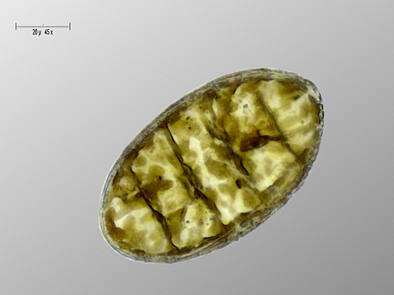 Cymatopleura elliptica