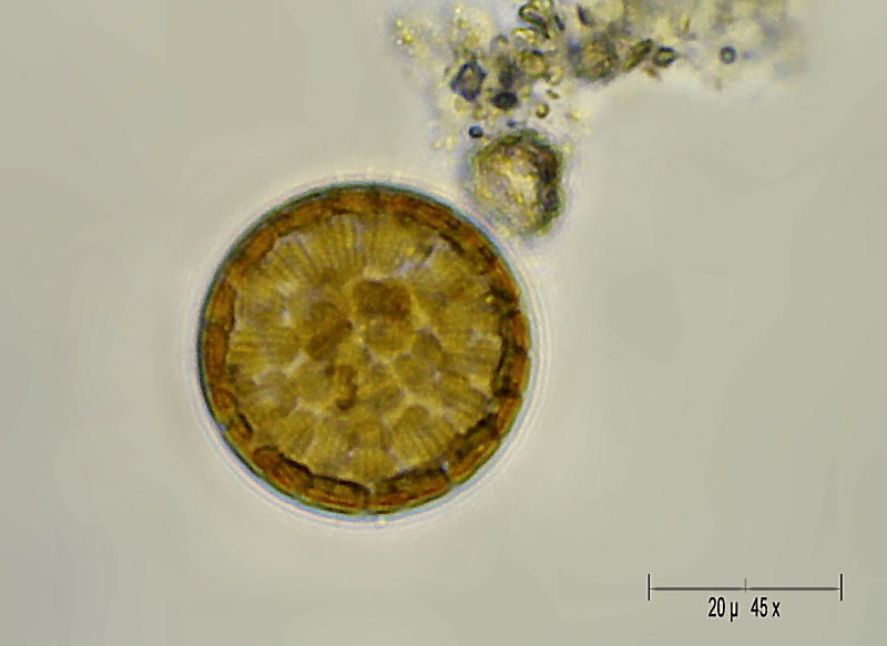 Cyclotella sp.