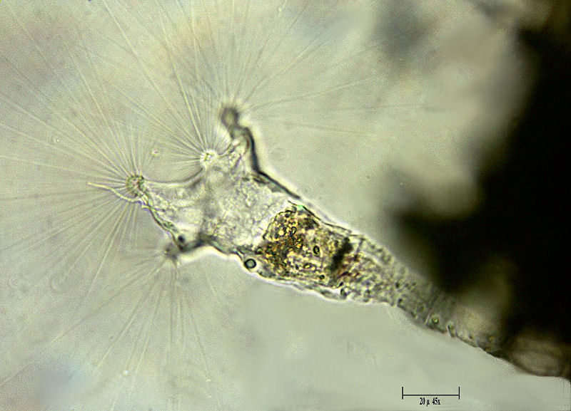 un rotifero dalle cilia lunghissime - Collotheca sp.