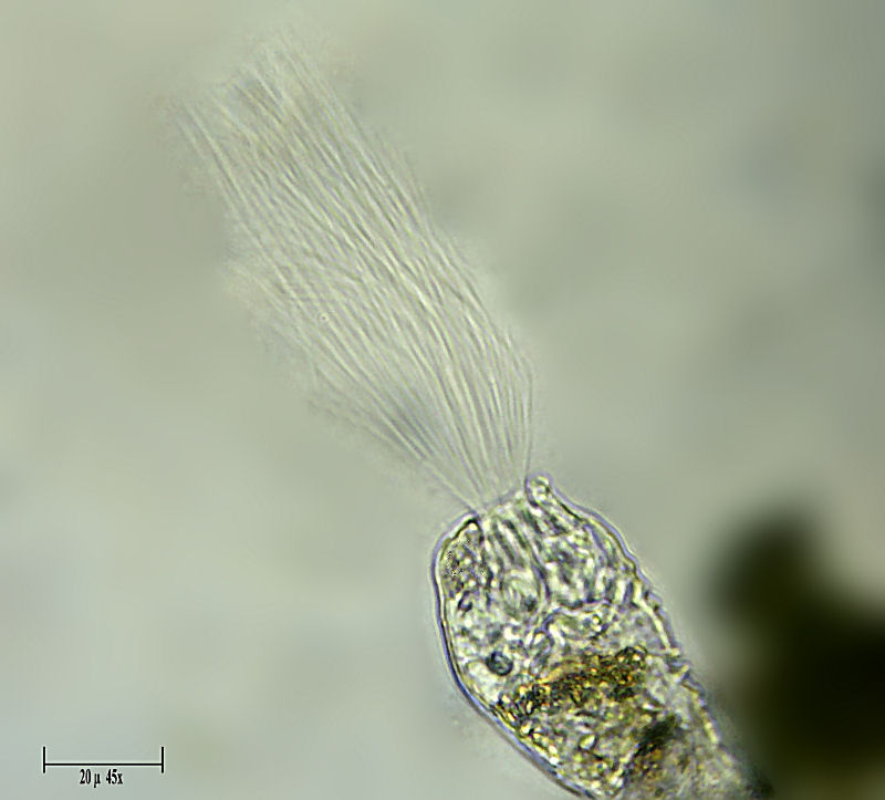 un rotifero dalle cilia lunghissime - Collotheca sp.