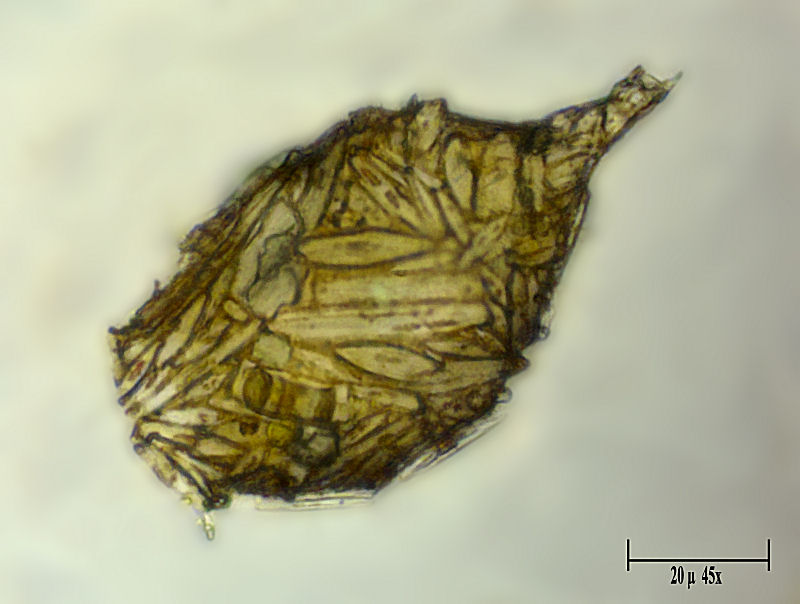 Difflugia acuminata  con teca di diatomee