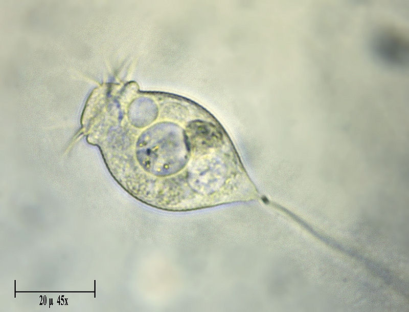 Vorticella sp.