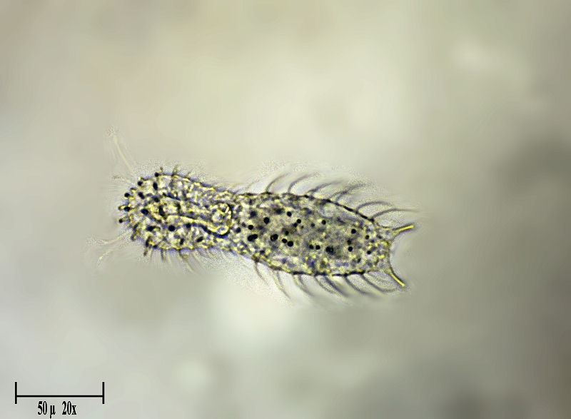 Chaetonotus sp.