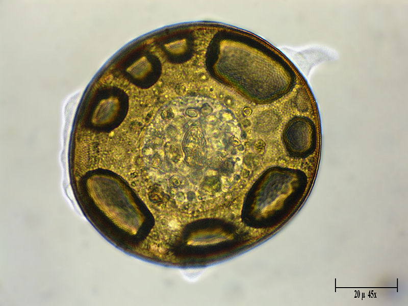 Arcella vulgaris   viva