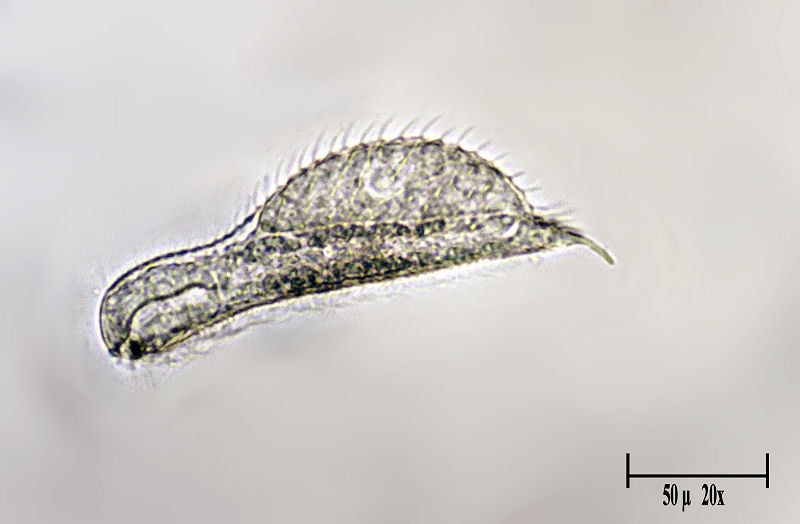 Chaetonotus sp.