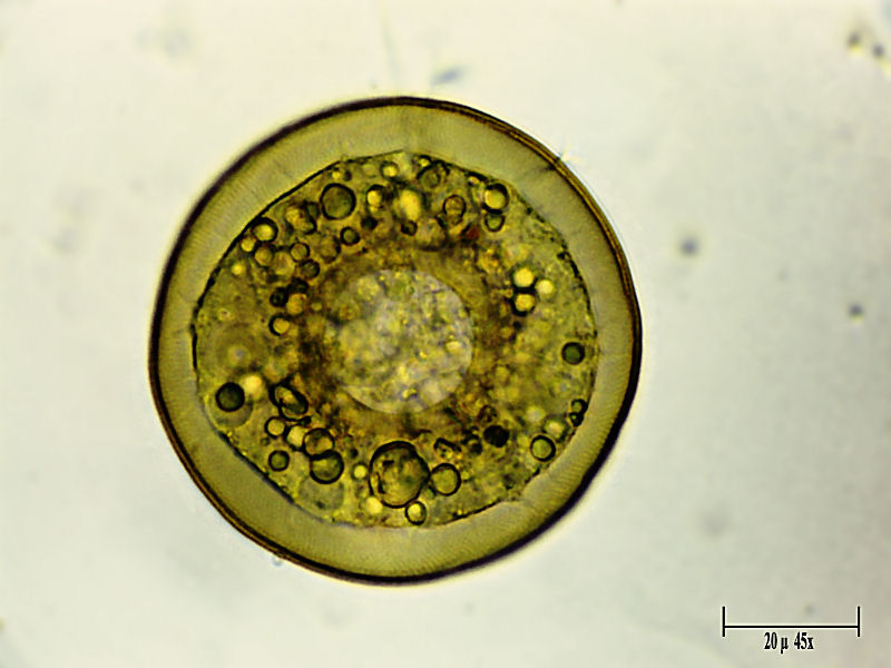 Arcella discoides