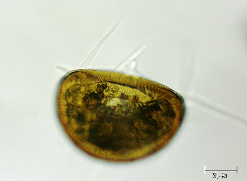 Arcella vulgaris   viva