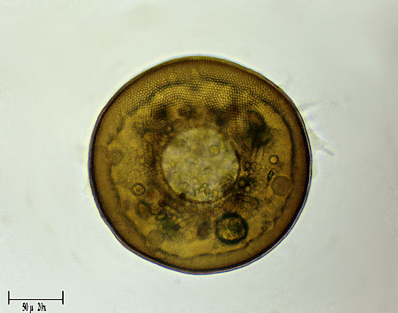 Arcella vulgaris   viva