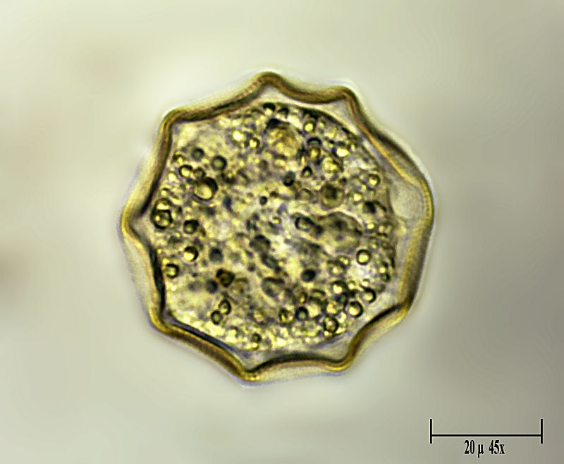 Arcella gibbosa 2