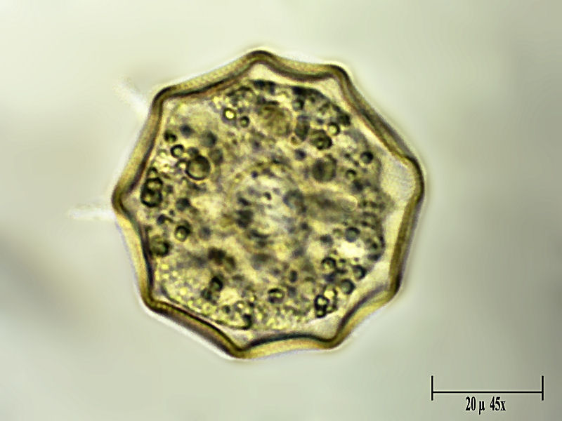 Arcella gibbosa 2