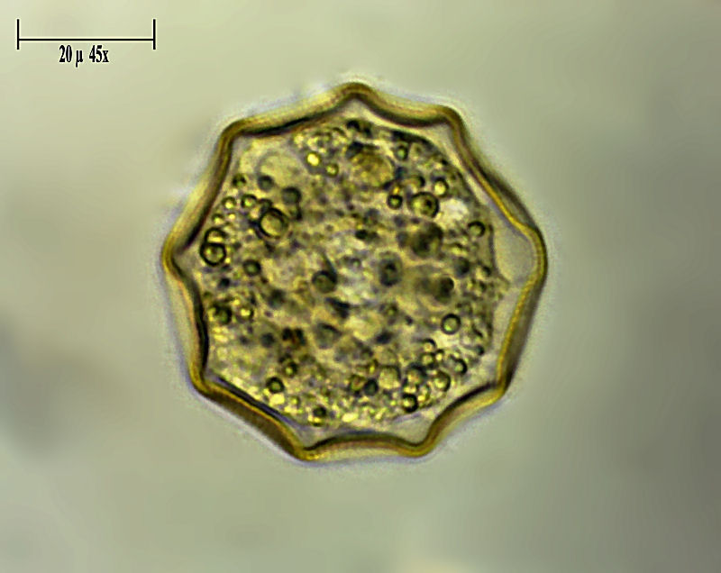 Arcella gibbosa 2