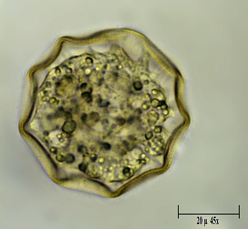 Arcella gibbosa 2