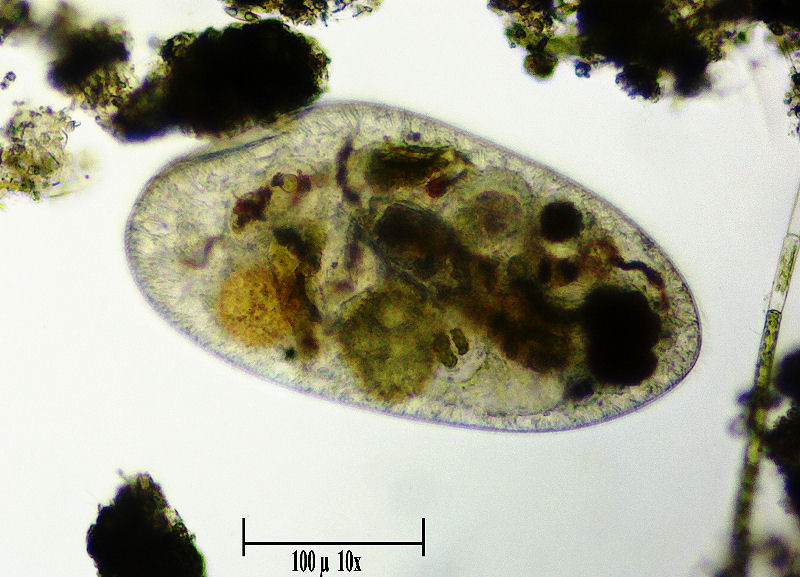 qualche scatto ad un grosso ciliato - Frontonia sp. ??