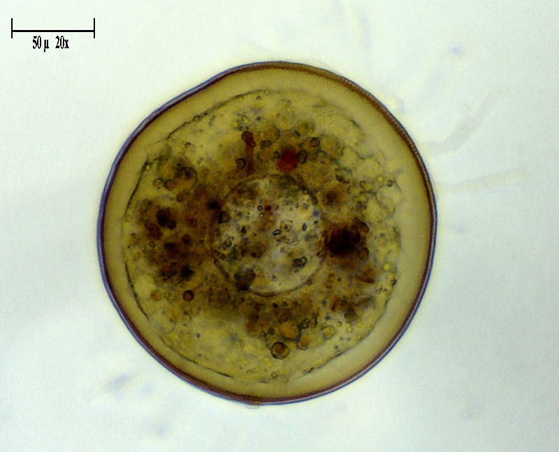 Arcella discoides