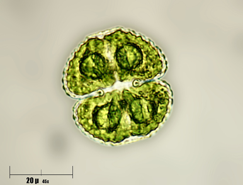 Cosmarium botrytis 2