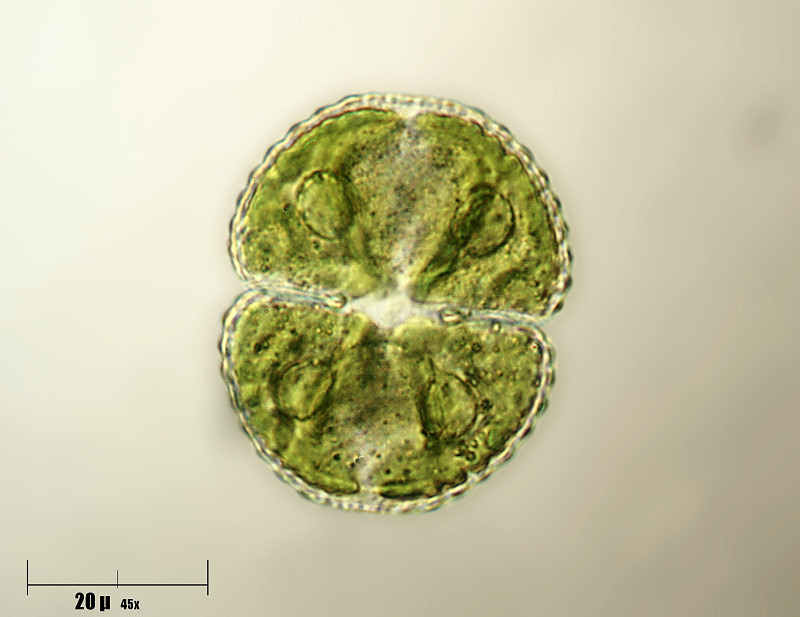 Cosmarium botrytis 3