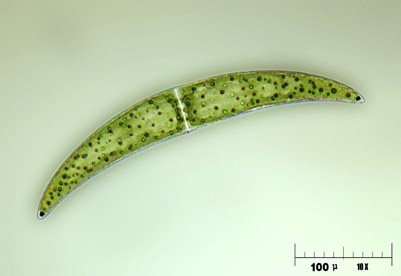 Closterium ehrenbergii 2