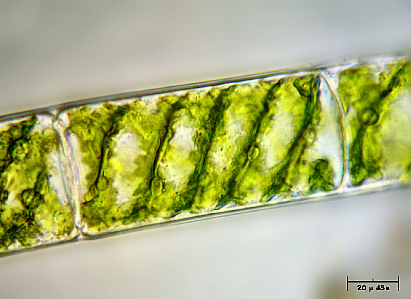 Spirogyra sp.