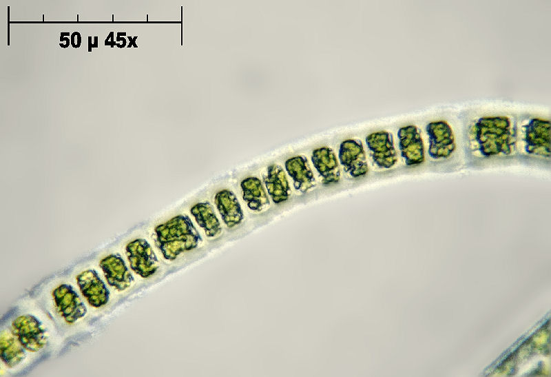 Hyalotheca sp.